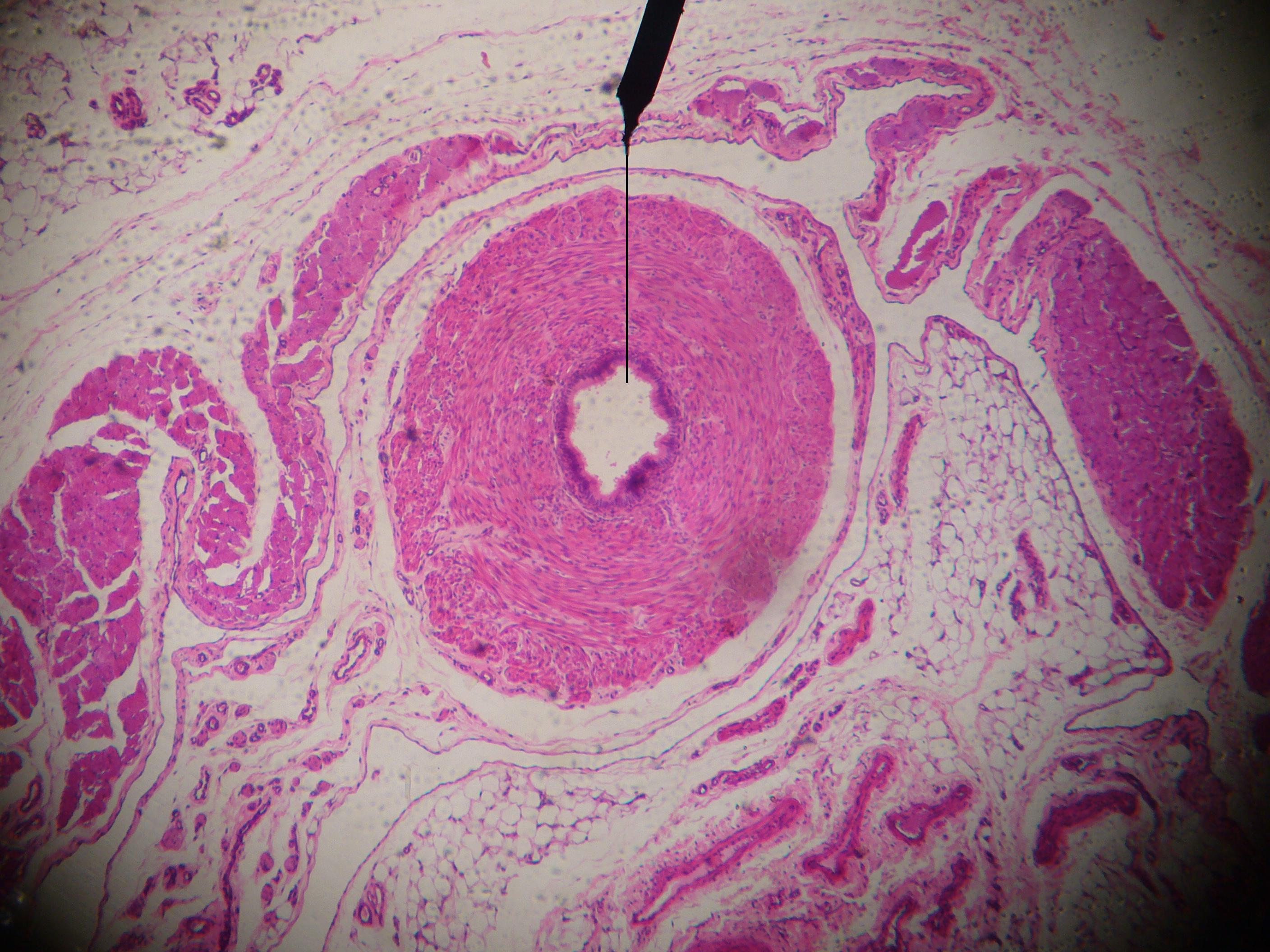 penis na mikroskopie